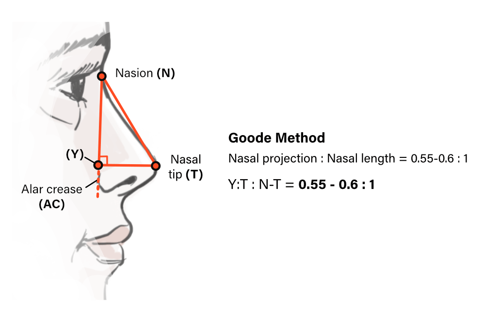 Goode Method